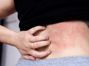 Dermatologie clinique pour les professionnels de santé